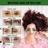 Under Eye Masks for Dark Circles and Puffiness 70PCS, Under Eye Patches for Puffy Eyes Treatment, Under Eye Gel Pads w/Seaweed, Aloe Vera, Peptides for Eye Bags Treatment, Eye Mask Patches Skincare