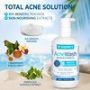 Vigority Benzoyl Peroxide Acne Treatment Wash: 10% Benzoyl Peroxide Face Body Wash - Maximum Strength Ance Non-Foaming Facial Wash - Fast Acting Acne Control Cleanser