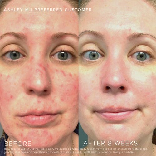 Rodan + Fields Soothe Calming Gel Cleanser 125 ml | Gentle Cleanser for Dry & Sensitive Skin | Daily Face Cleanser for Women and Men, Moisturizing & Hydrating Skincare