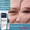 Dr Crazy CPR Repair Eye Cream | Eye Cream for Puffiness and Bags Under Eyes | Dark Circles Under Eye Treatment | Eye Bags Treatment for Women | 30ml