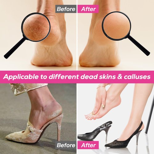 Professional Electric Foot File, Adjustable Rotatable Electronic Foot Dead Skin Remover Callus Remover Tool for Home & Nail Salon with 60 pcs Replacement Sandpaper Disk,Black