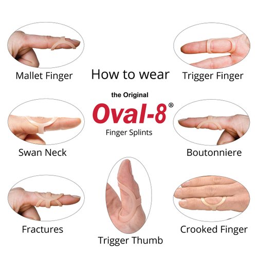 3-Point Products Original Oval-8 Finger Splints, Support and Protection for Arthritis, Trigger Finger or Thumb, and Other Finger Conditions, Complete Sizing Set