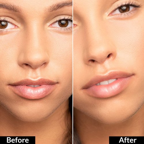 True + Luscious Flowerdose Lip & Eye Serum – 2-in-1 Lip Plumping & Eye Serum for Dry Lips and Dark Circles – Intensely Hydrating, Anti-Aging Formula – 0.5 oz