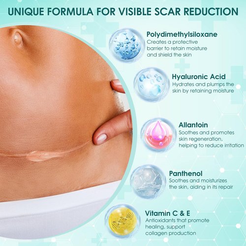 WOOKINGWA Silicone Scar Gel, Advanced Scar Gel for Surgical Scars, Non-Greasy Scar Cream with Allantoin, Vitamin C & E for Keloid, C-Section, Stretch Mark, Burn, Acne, Injury, 2 OZ