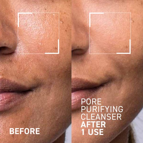 Dr. Brandt Skincare Pores No More Purifying Cleanser - Non-Drying Gel - Cleanses, Purifies, and Dissolves Excess Oil, Residue, and Debris - 3.5 fl oz / 105 ml