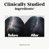 Gray Hair Rescind with Catalase - Anti-Gray Hair Supplements for Men and Women, Hair Vitamins Biotin, Saw Palmetto, Antiaging, Restores Natural Hair Color and Reverses Gray Hair at The Root