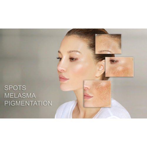 MT Skin Clinic Day Cream Moisturizer for Face Hydration Skincare for Sensitive Skin Acne Treatment and Redness Reducing Moisturizing Facial Cream Rosacea Daily Skin Care Routine Women and Men