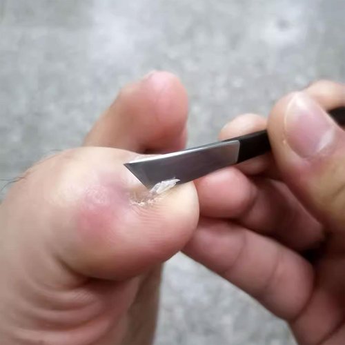 4 Pcs Pedicure Knife Set, Stainless Steel Foot File Rasp Dead Skin Corn Foot Callus Remover Kit Ingrown Toenail Knife Tools Foot Scraper Knife for Dead Skin (Black)