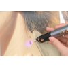 Skin Clinic Freeze Point for Warts and Skin Tags