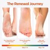 modelones Foot Peeling Mask 3 Pack, Exfoliating Foot Mask for Dry Cracked Feet, Callus Dead Skin Remover for Feet, Additional 3 Pack Collagen Serum for Reviving Baby Soft Smooth Feet, Women and Man