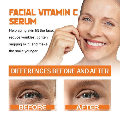 Vitamin C facial moisturizing anti-aging essence, 30ml brightening and soothing formula, suitable for women's skin care with various skin types 2PCS