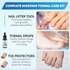 Xtreme Derma Ingrown Toenail Treatment - 3 in 1 Ingrown Toenail Removal Kit + Pain Relief - Ingrown Toenail Drops + Toe Protectors + Nail Lifter