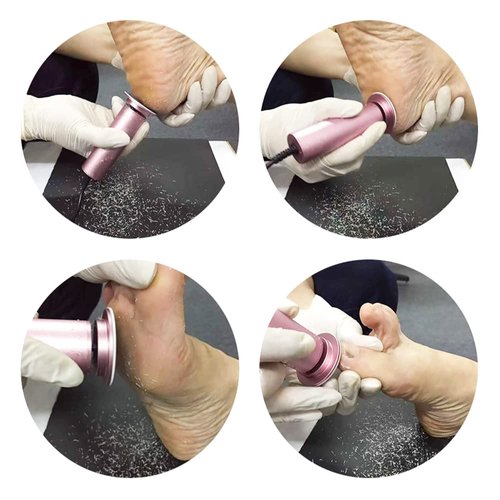 Dr.Pedi Electric Callus Remover for Feet Speed Adjustable Electric Foot File with 60pcs Replacement Sandpaper Discs Pro Pedicure Foot Filer Dead Dry Hard Skin Calluses Foot Grinder Pink