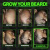GROW Maximum XXL Hair & Beard Growth Oil For Men • Beard Growth Serum That Fills Patches & Fix Thinning GUARANTEED • Facial Hair & Scalp Treatment • Thickening Conditioner & Enhancer • Made in the USA