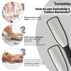 Swissklip Foot File Callus Remover for Feet I A Perfect Heel Scraper for Cracked Heels I Luxurious Foot Scraper for Callus Removal and Dead Skin Remover for Feet (1 Pack)