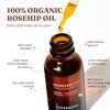 Offernova Organic Rosa de Mosqueta Oil- USDA Certified Rosehip Seed Oil Pure Cold Pressed, Repairs & Brightens Skin - Gua Sha Massage, Face, for All Skin Types - Aceite Facial 1OZ