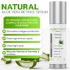 Aloemoist 2.5% Retinol Serum for Face + Hyaluronic Acid, Aloe Vera, Vitamin E Oil, Jojoba Oil, Vitamin C Serum – Face Toner, Pore Minimizer, Acne Treatment, Reduces Wrinkles Fine Lines, Age Spots .5oz
