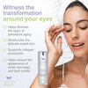 YOUN Beauty Retinol Eye Cream by Holistic Plastic Surgeon Dr. Anthony Youn – Paraben-Free Night Eye Cream with 1% Retinol and Hyaluronic Acid – Under Eye Cream for Hydration and Skin Firming, 1 Fl Oz