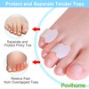 Povihome 10 Pack Pinky Toe Separators, Little Toe Spacers to Separate and Protect Pinky Toe or Smaller Toes, Relieve Pain from Friction and Pressure