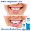 EverSmile AlignerFresh Original Clean-The Original Cleaning WhiteFoam On-The-Go Clear Retainer Cleaner. Eliminates Bacteria, Whitens Teeth & Fights Bad Breath (25ml - 2 Pack)