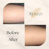 Kenzzi IPL Hair Removal Device - Permanent Hair Remover and Hair Growth Reduction Handset for Long Lasting Results - Pain-Free At Home Laser Hair Removal for Whole Body Treatment