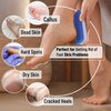 Slick- Pumice Stone for Feet Callus Remover, 4 Pack, 2 Colors, Foot Scrub for Pedicure, Foot Stone Pumice, Callus Remover for Feet, Foot Callus Remover, Feet Scrubber Dead Skin, Foot Pumice Stone