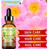 Botanical Beauty ROSEHIP SEED OIL Pure For Face, Skin, Hair and Body. Anti-Aging Moisturizer Facial Oil 2 Fl oz 60 ml