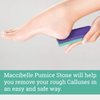 Maccibelle Salon Foot Pumice and Scrubber for Feet and Heels Callus and Dead Skins, Safely and Easily Eliminate Callus and Rough Heels (Pack of 12)