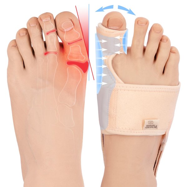 PEDIGOO Bunion Corrector for Women 2pc, Non-Slip Bunion Toe Separator, Hallux Valgus Relief for Day/Night Support (Beige)