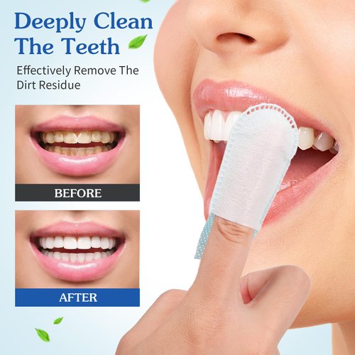 Beavorty Cleaning Wipes 50 Pcs Disposable Deep Cleaning Teeth Wipes Finger Toothbrush Oral Finger Wipes Teeth Whitening Wipes Oral Cleaning Wipe for Oral Brush Ups Mini Toothbrush