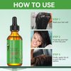 Rosemary Hair Growth Oil and Serum - Dry Scalp Treatment, Hair Thickening Products for Women, Hair Loss Essential Oils for Diffuser (2OZ)