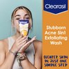 Clearasil Stubborn Acne Control 5in1 Exfoliating Wash, Maximum Strenght with 2% Salicylic Acid Acne Treatment Medicine, Daily Acne Facial Cleanser 6.78 fl oz