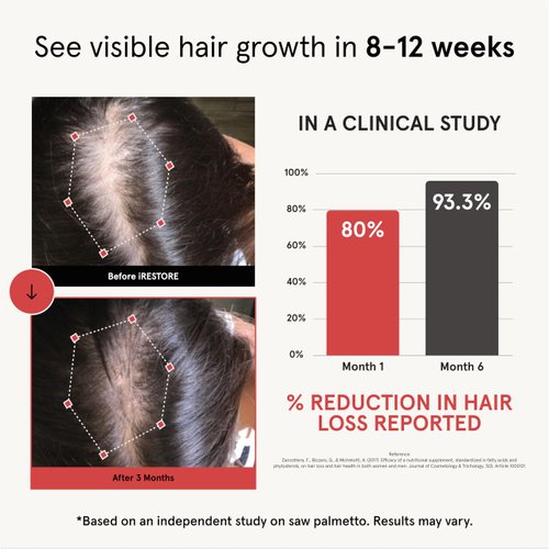 iRestore Hair Growth Supplement – Natural DHT Blockers & Multivitamin Blend – Vegan, Non-GMO, 90 Capsules – Supports Thicker, Stronger Hair for Men and Women – 2-Pack