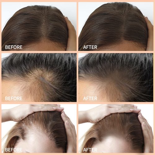 Boobeen Hair Shadow Powder Kit, Root Touch Up Powder Cover Hair Color, Temporary Concealer Powder with Brush for Gray Hair Root