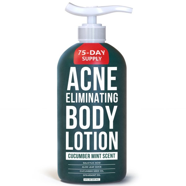 TreeActiv Acne Eliminating Body Lotion, 8 fl oz, Salicylic Acid Lotion, Salicylic Acid Body Acne Treatment, Back Acne Treatment Cream for Women and Men, Acne Lotion for Body, Zit Cream with 2000+ Uses