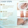 Callus Remover for Feet (Extra Strength) Foot Scrubber for Dead Skin Callus Gel - Professional Pedicure Foot Spa Essential, 6oz