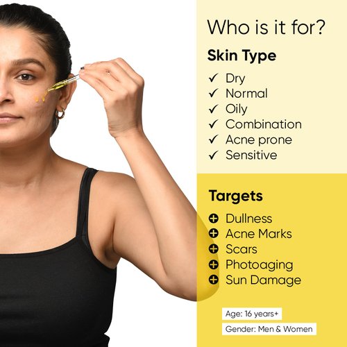 Minimalist Rosehip Oil with Vitamin C for Anti Aging & Glowing Skin | Fades Acne Marks & Scars & Reduces Photoaging | Pure & Cold Pressed | For Women & Men | 1 Fl Oz / 30 ml