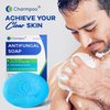 CHARMPOO Antifungal Soap Bar for Itchy Skin: Helps Relieve Athletes Foot & Fungal Discomfort – Moisturizing pH-Balanced Gentle on Sensitive Skin for Body & Feet - 4.5 oz