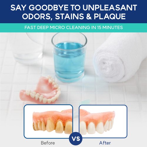 Cleaner Perfect for Invisalign, Retainer, Mouth Guard, Aligner, Night Guard - Denture Cleaning Tablets Crystals - Removes Odors, Stains, Plaque -60 Fresh Mint Retainer Cleaner Tablets for Invisalign