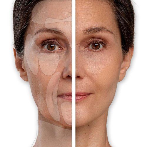 REUSABLE Forehead Wrinkle Patches - Wrinkle Patches - Silicone Face Patches - Silicone Patches for Wrinkles - Forehead Wrinkles Treatment - Silicone Face Mask - Facial Patches for Wrinkles