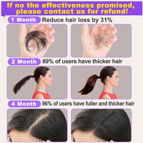 Rosemary Hair Growth Serum 2 Pack with Scalp Massager - Biotin, Argan Oil and Castor Oil for Thinning, Dry, Damaged Hair - Regrowth Treatment for Women