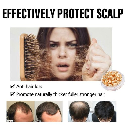 Hair Treatment Serum- Hair Vitamin Oil Capsules for Hair Growth Treatment with Avocado & JoJoba Oil, Vitamins A C E Pro Hair Scalp Serum Hair Growth Serum- no Rinse Conditioner for Women & Men