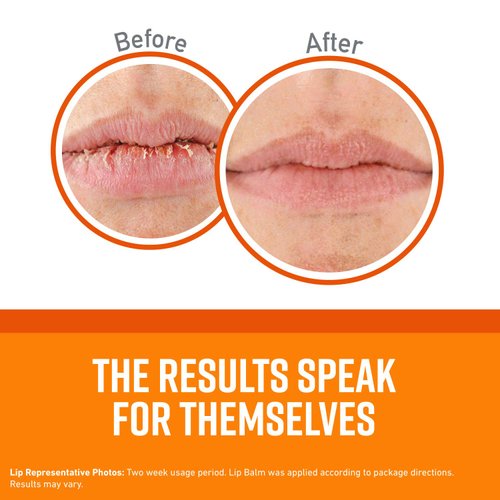 O'Keeffe's Unscented Lip Repair Lip Balm for Dry, Cracked Lips, Stick, (Pack of 9)