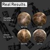 évolis REVERSE Repair Treatment Mask | Hair Mask for Hair Growth | Deep Conditioning Hair Mask | Hair Growth Treatment | Hair Repair Mask | Hair Mask for Color Treated Hair (8.5 fl oz)