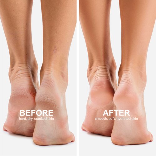 Original Derma Beauty Foot Mask 6 Pairs Shea Butter + Avocado Moisturizing Foot Mask Body Exfoliator Callus Remover Foot Bath Pedicure Supplies