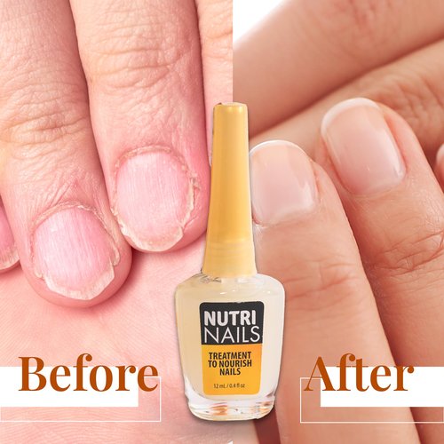 Amen Beauty Nutri Nails: Nail Strengthener with Proteins, Minerals, Hyaluronic Acid & Vitamins - Nail Hardener, Growth & Nail Biting Treatment for Damaged Nails and Adults.