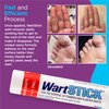 WartStick Maximum Strength Salicylic Acid Solid-Stick Common and Plantar Wart Remover 2 Pack, 0.4 Oz