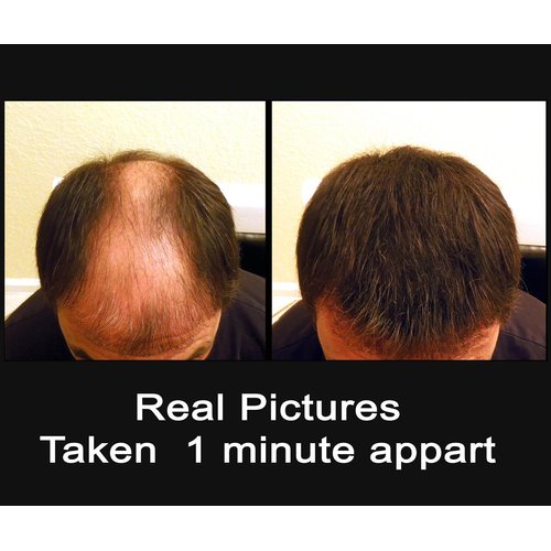 BLACK 100 GRAMS SUPER SIZE Original Samson Hair Building Fibers Refill for all brands