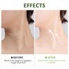 PEAQ SKIN, PEAQ Neck Firming Cream, PEAQ AH-8 Firming Lifting Neck Cream with Roller, Lifting Loose Skin, Smooths Wrinkles & Moisturizing Skin Care (2)