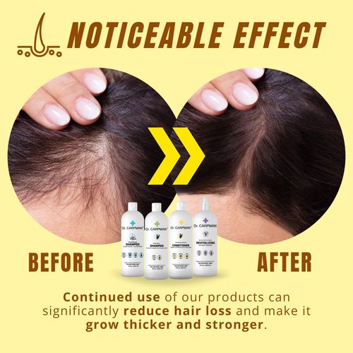 Dr. Carpman - Shampoo and Conditioner for Hair Growth - All-Natural Thinning Hair Regrowth Formula - Anti Hair Loss Treatment for Women & Men - Ideal for Color Treated Hair (2 x 32 Fl. Oz.)